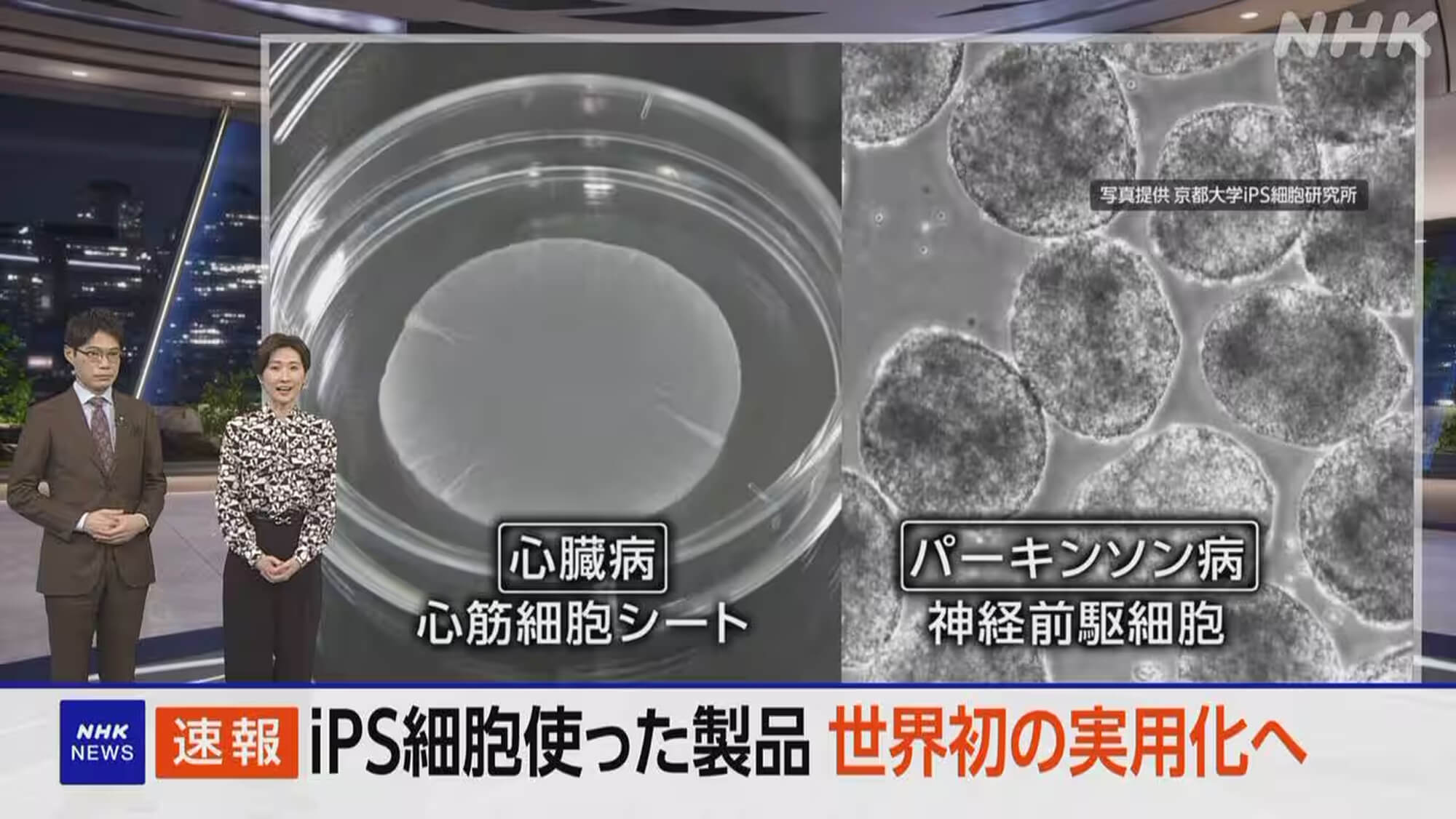 iPS細胞、ついに実用化へ。