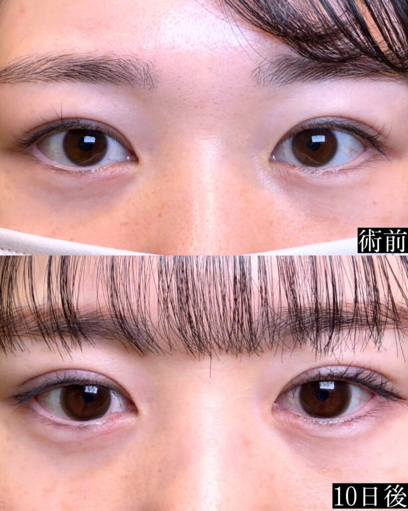 症例 ビフォーアフター