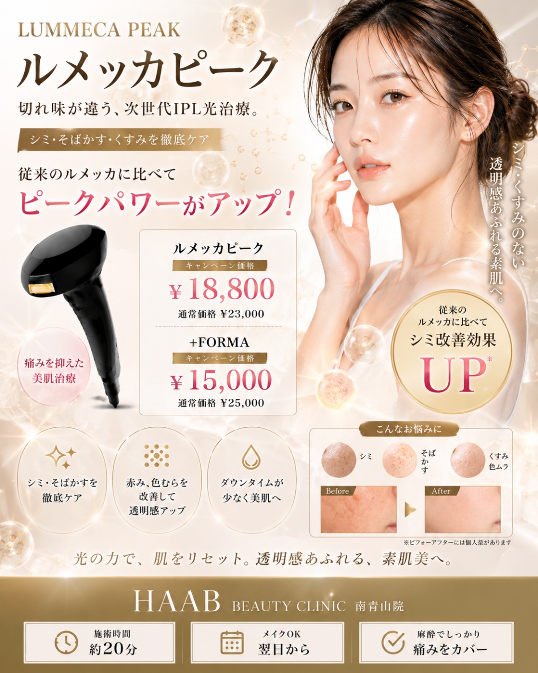 最新しみ治療『Lumecca Peak』
